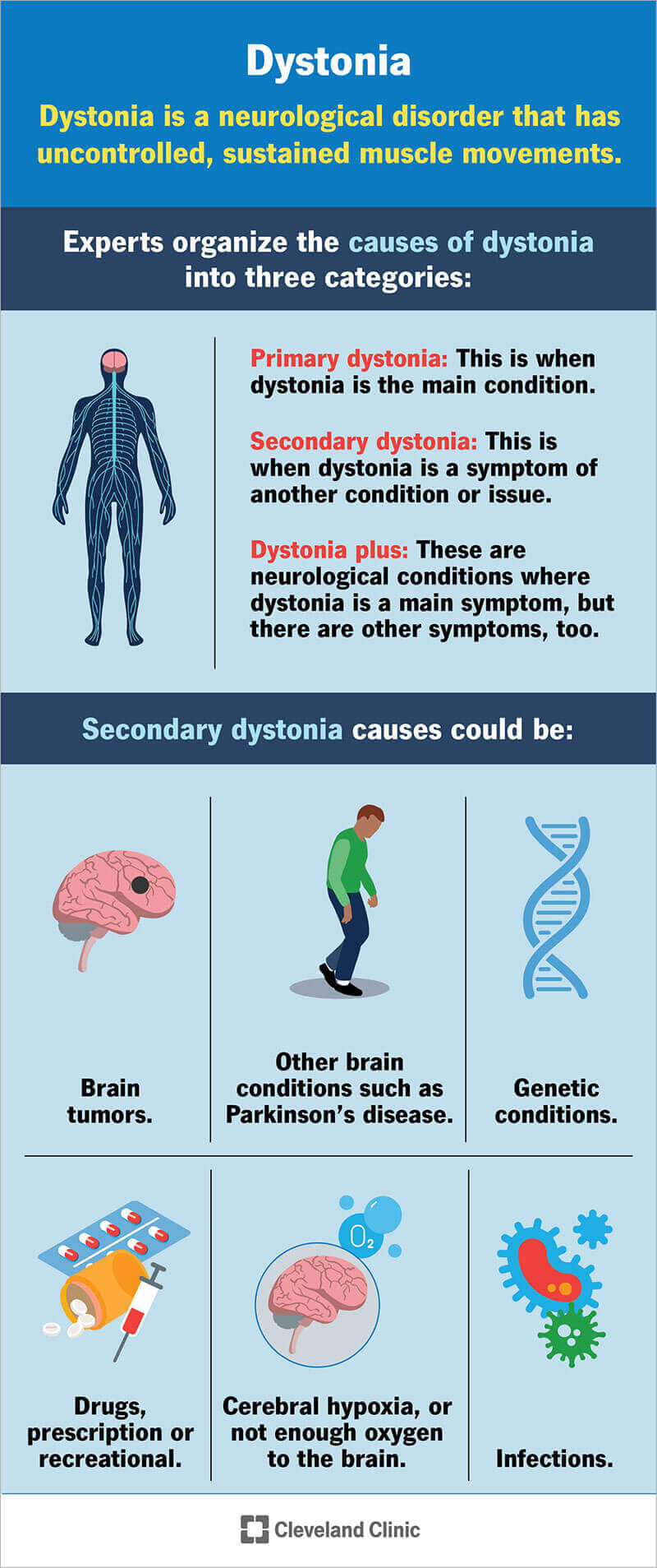 La distonia può causare movimenti muscolari incontrollati e i suoi effetti dipendono dalla parte del corpo in cui si verifica e dalla causa.