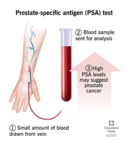 psa test