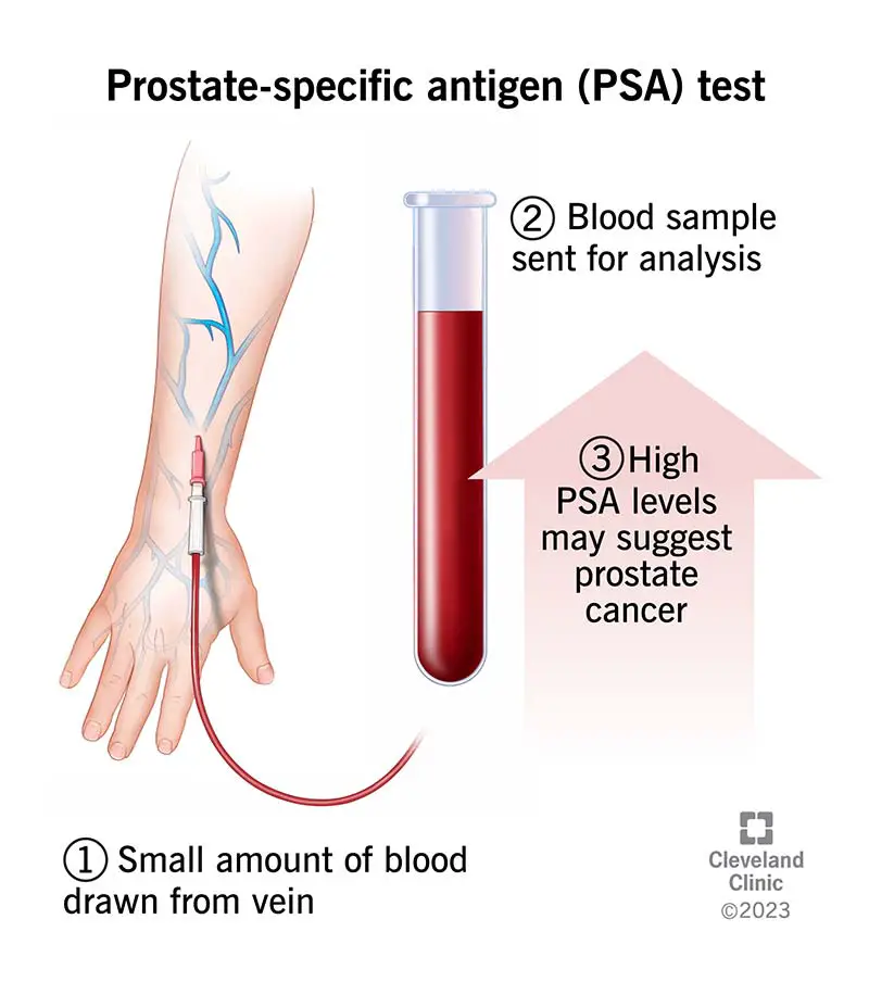 psa test