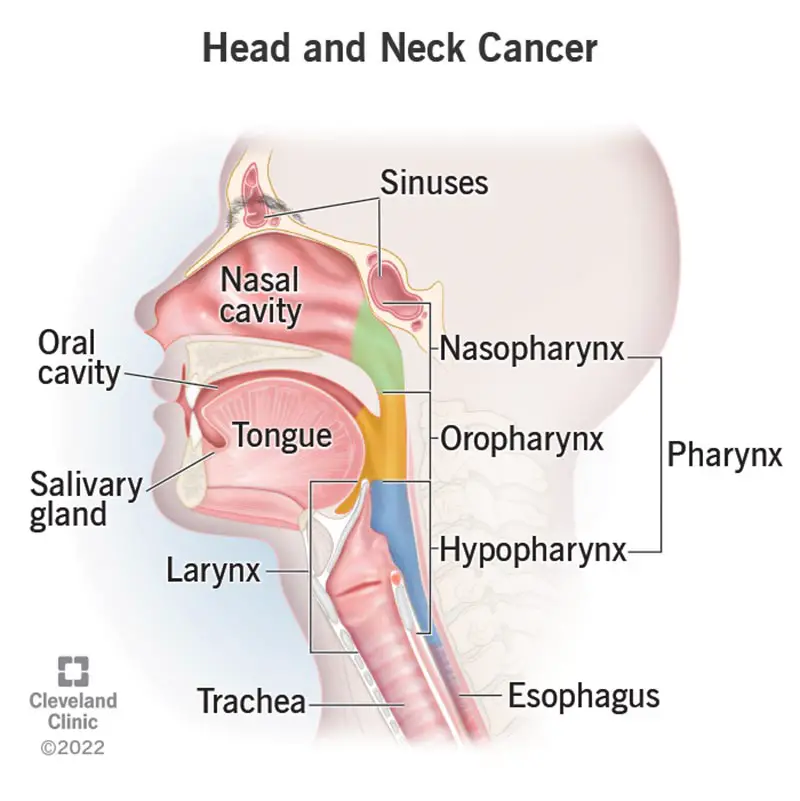 Le zone della testa e del collo in cui il cancro si forma più comunemente sono la cavità orale, la faringe e la trachea.