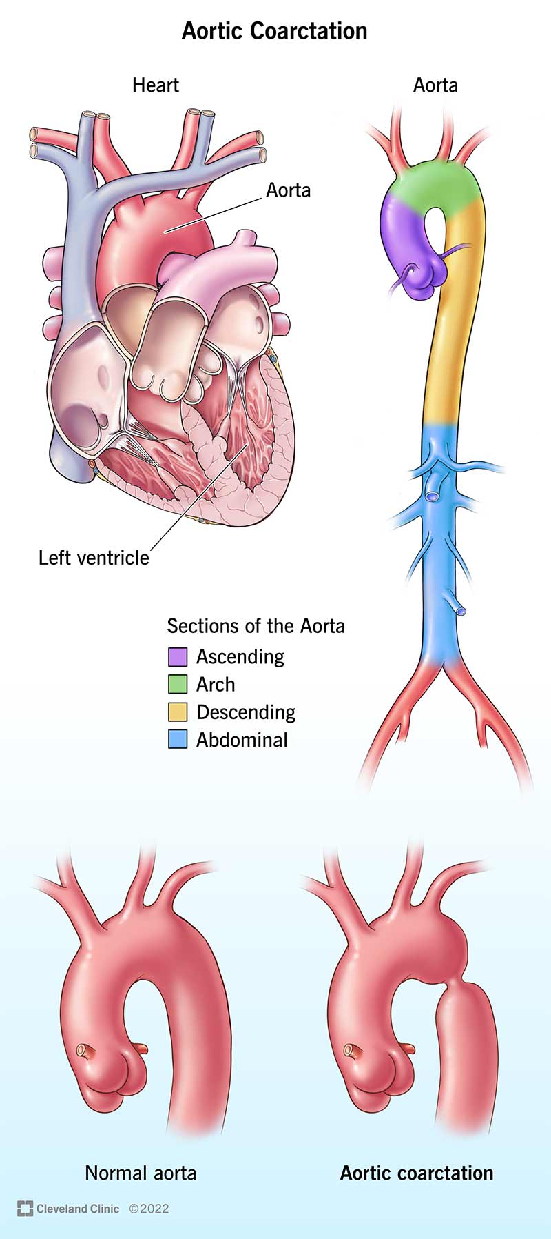 Gruppo di illustrazioni che mostrano l'anatomia del cuore e dell'aorta.