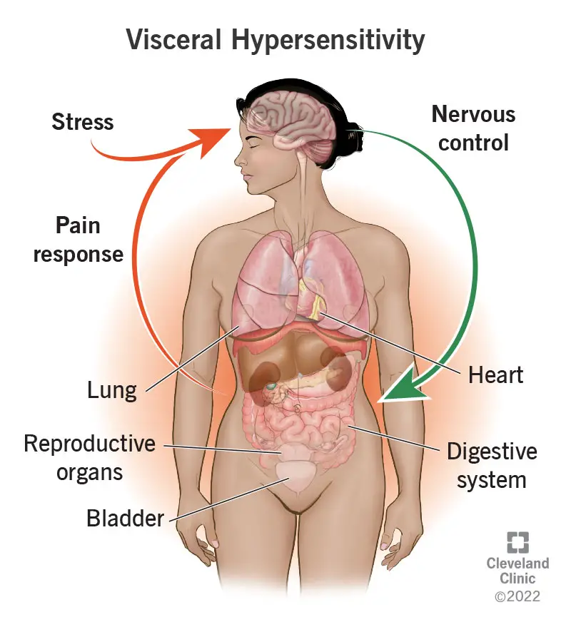 1725747616 22997 visceral hypersensitivity