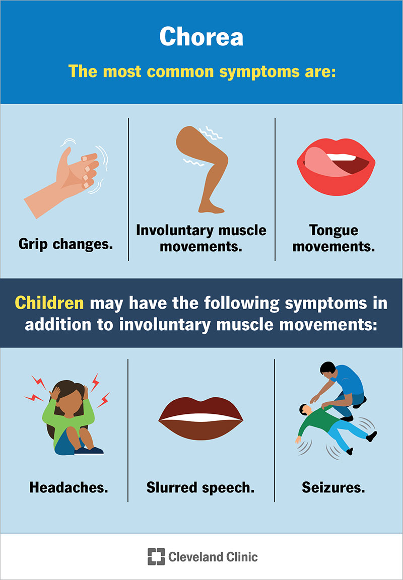 Sintomi della corea negli adulti e nei bambini.