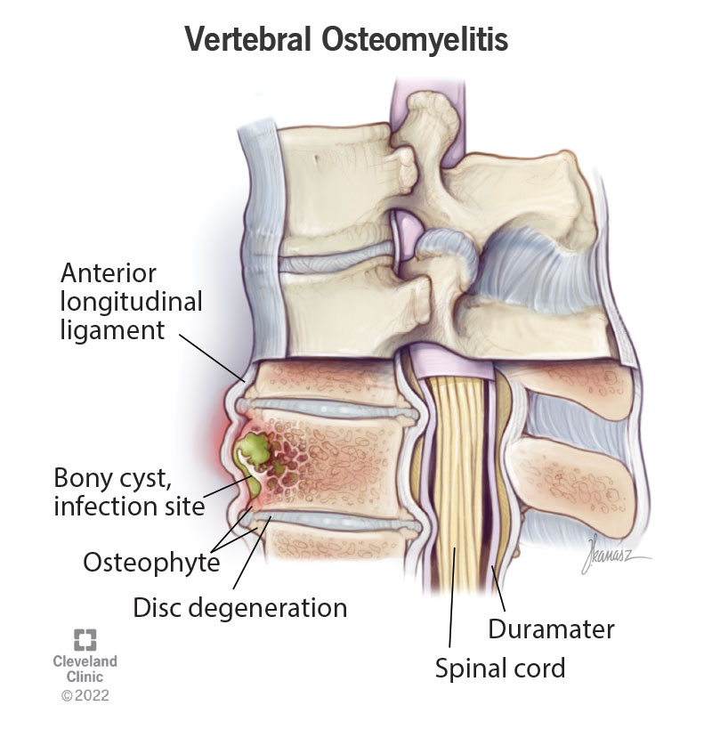 La colonna vertebrale è composta dai legamenti longitudinali anteriori e posteriori, dal midollo spinale, dall'aracnoide e dalla dura madre.