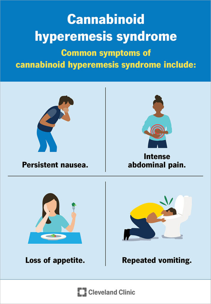 Sindrome da iperemesi da cannabinoidi (CHS): cause, sintomi e trattamento 3 cannabinoid hyperemesis syndrome feature