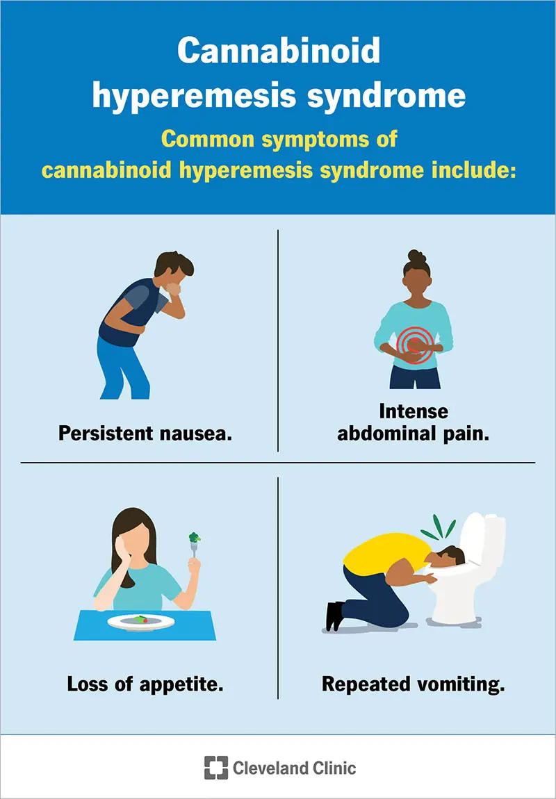 I sintomi della sindrome da iperemesi da cannabinoidi includono nausea, vomito ripetuto e dolore addominale.