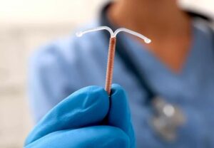 copper IUD doctor 1407068762 770x533 1 jpg