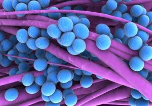 Staphylococcus 116975927 770x553 jpg