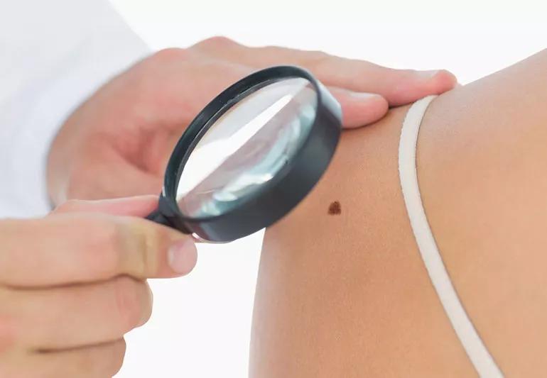 skin cancer check doc office 494372287 770x533 1 jpg