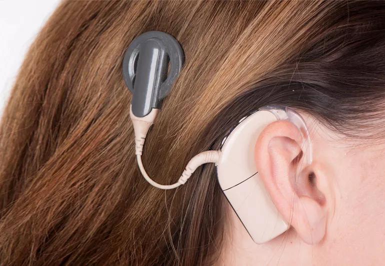 cochlearImplant 464470338